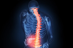 What is a Work Related Muscular Skeletal Disorder (WMSD)?